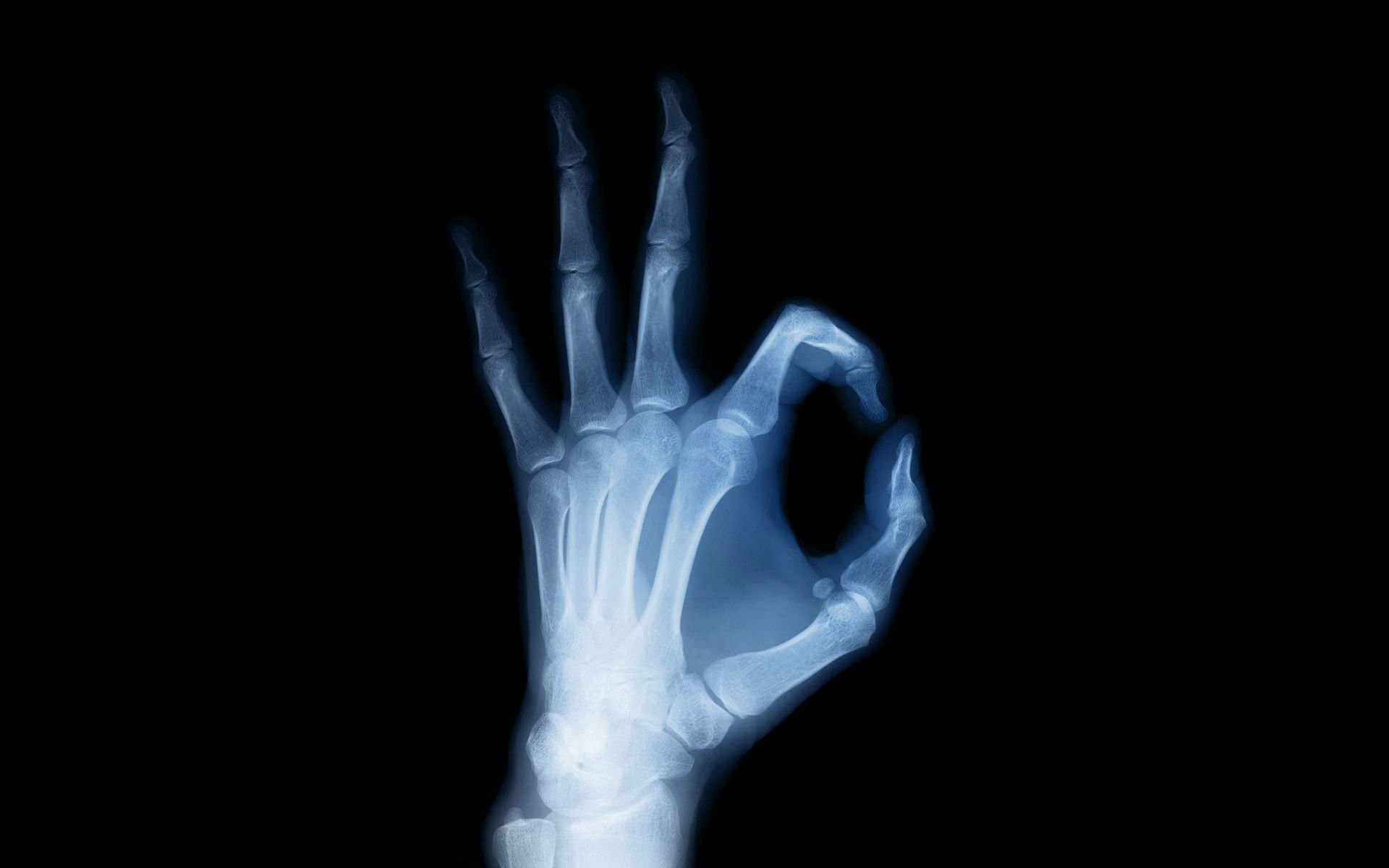 X Ray Hand Anatomie Wallpaper 
 Data Src X Ray Wallpaper - X Rays - HD Wallpaper 
