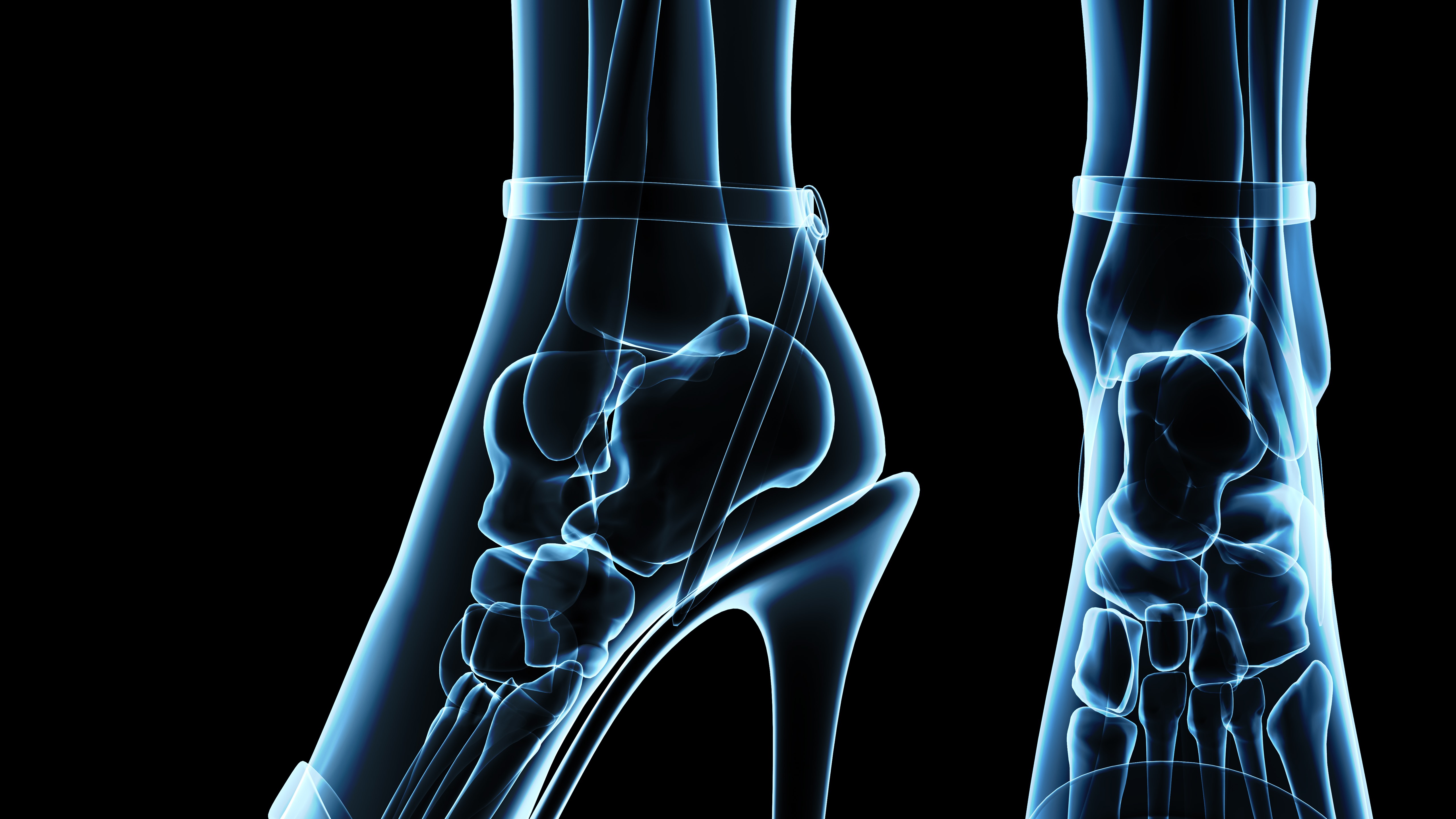 Wallpaper Girl Legs, Bones, Heels, X-ray - Skeleton Legs In Heels - HD Wallpaper 