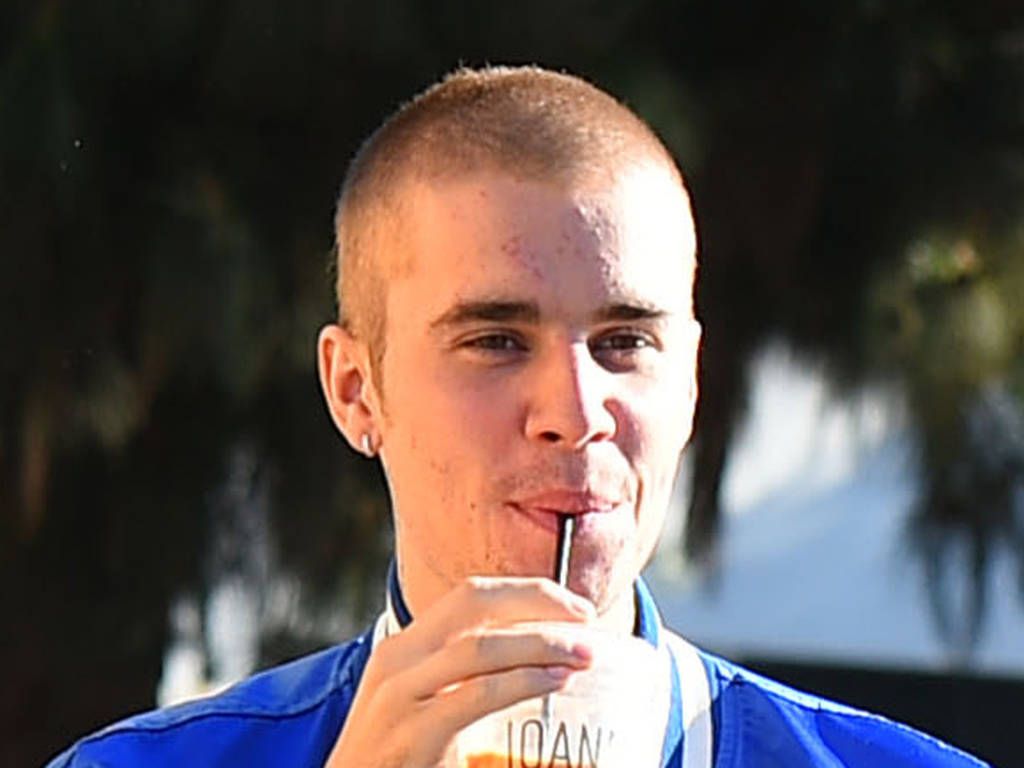 Taylor Swift Post Surgery Banana - HD Wallpaper 