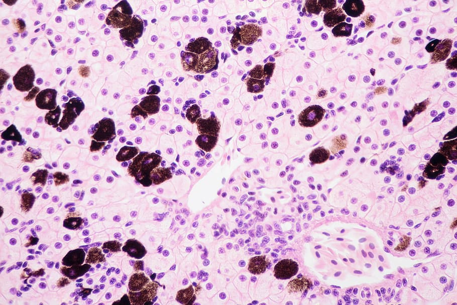 Light Microscope View Of Liver Cells, Science, Biology, - Celulas Del Higado De Una Vaca - HD Wallpaper 