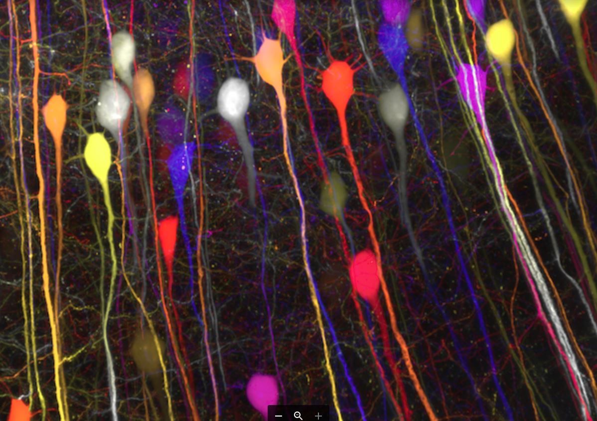 Laser Brain Microscope Alzheimers Nerve - Neurons Firing In Brain - HD Wallpaper 