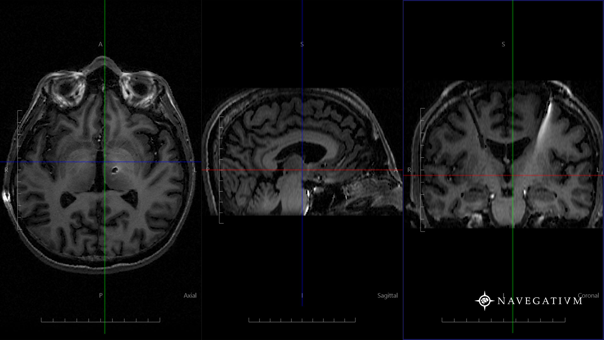 Radiology - HD Wallpaper 