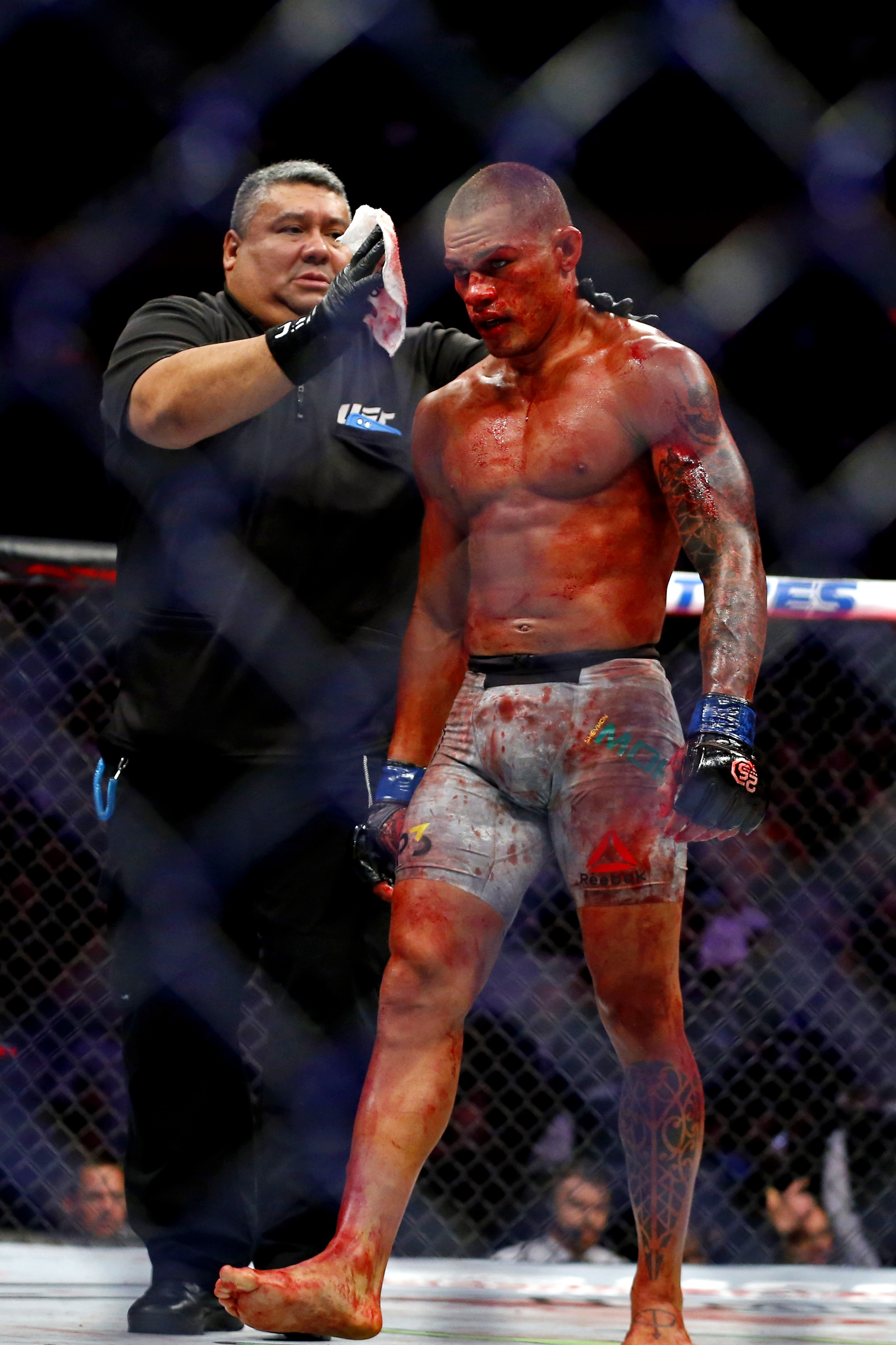 Ufc Blood - HD Wallpaper 