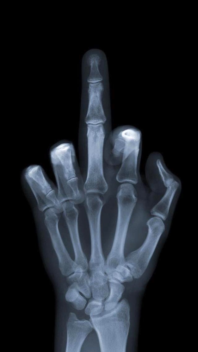 Middle Finger X Ray - HD Wallpaper 