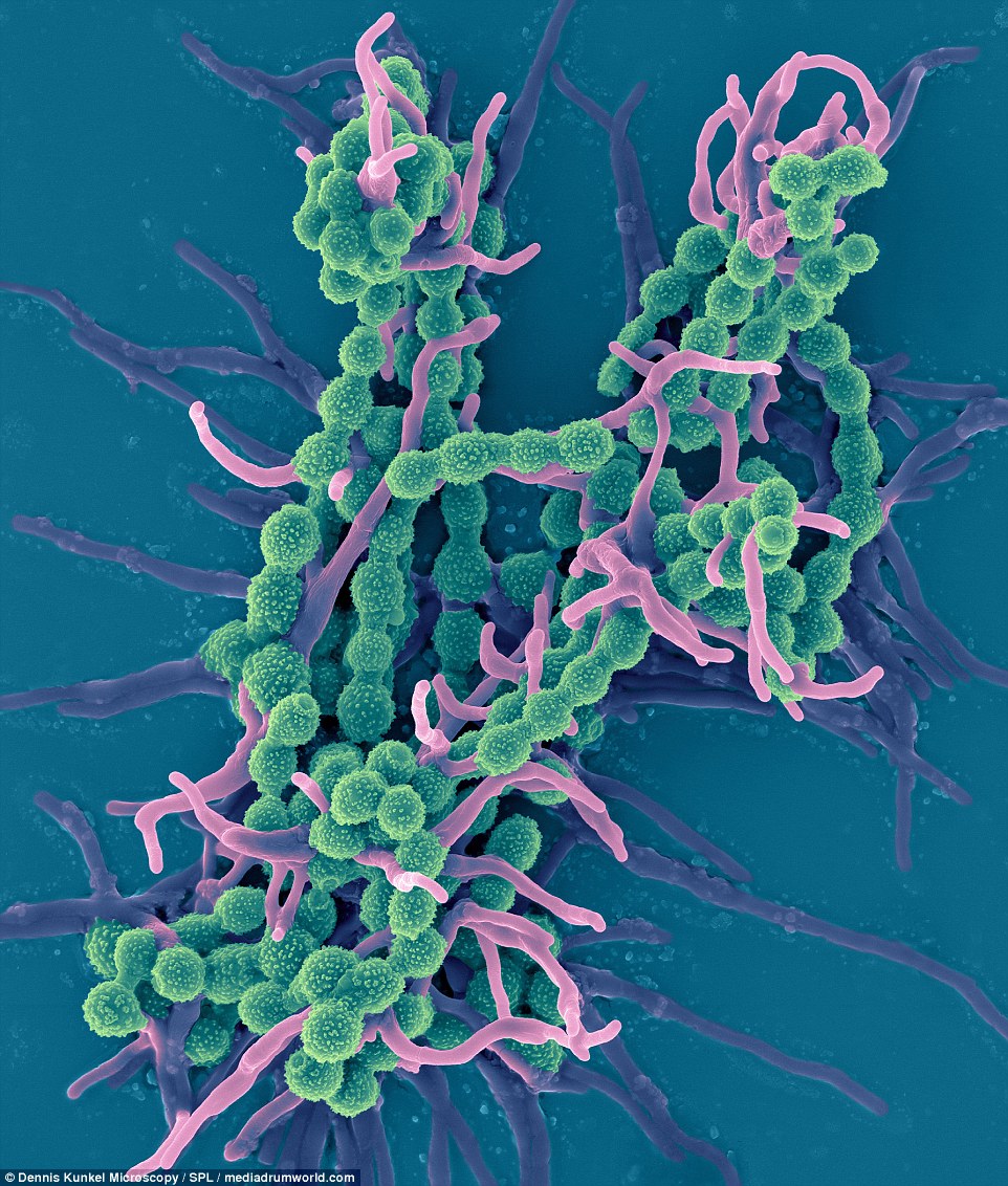 Scopulariopsis Brevicaulis Occurs Worldwide As A Saprotroph - Mikroskopie Von Scopulariopsis Brevicaulis - HD Wallpaper 