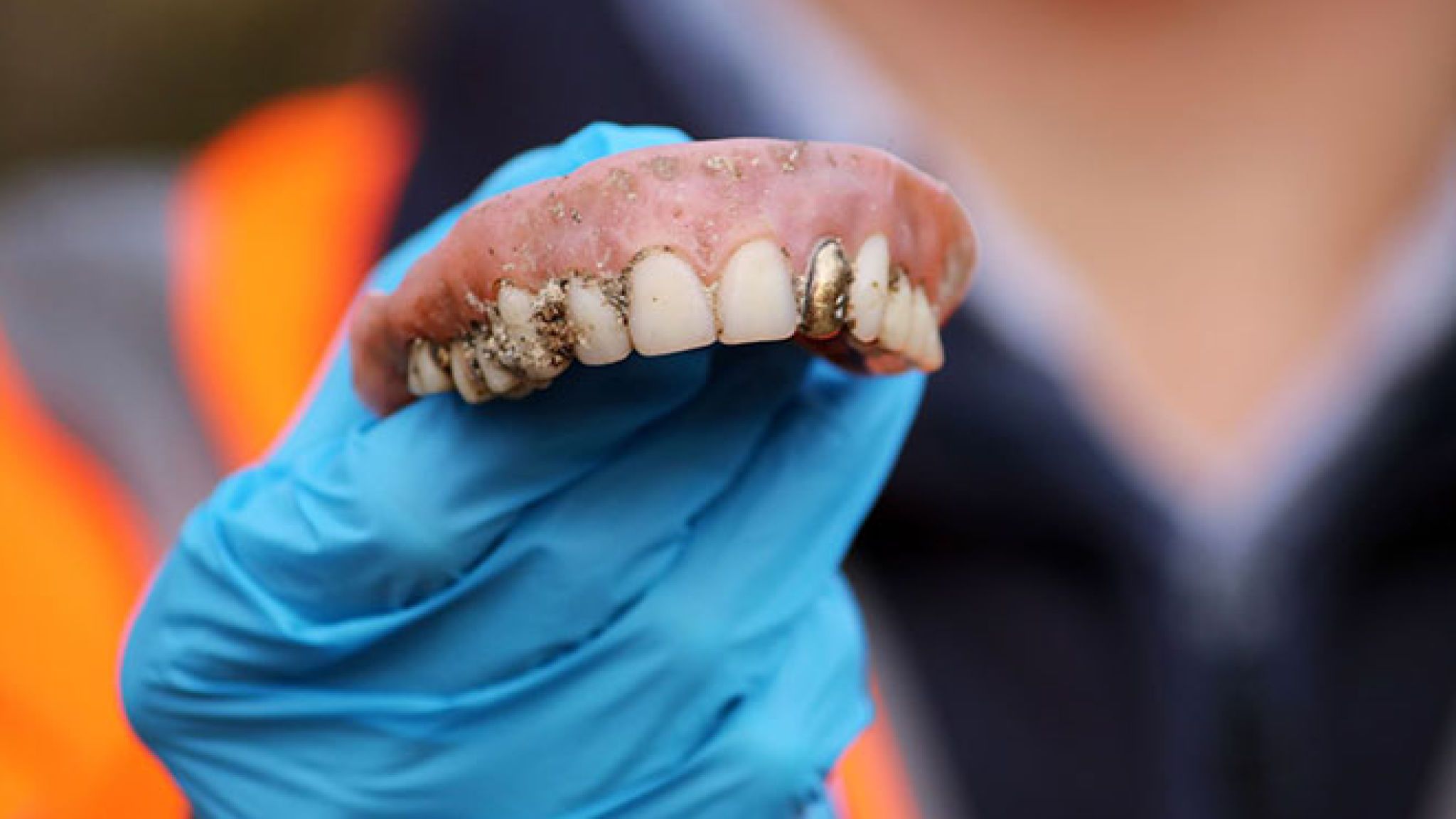 The False Teeth, With A Gold Tooth, Were Found At A - False Teeth
