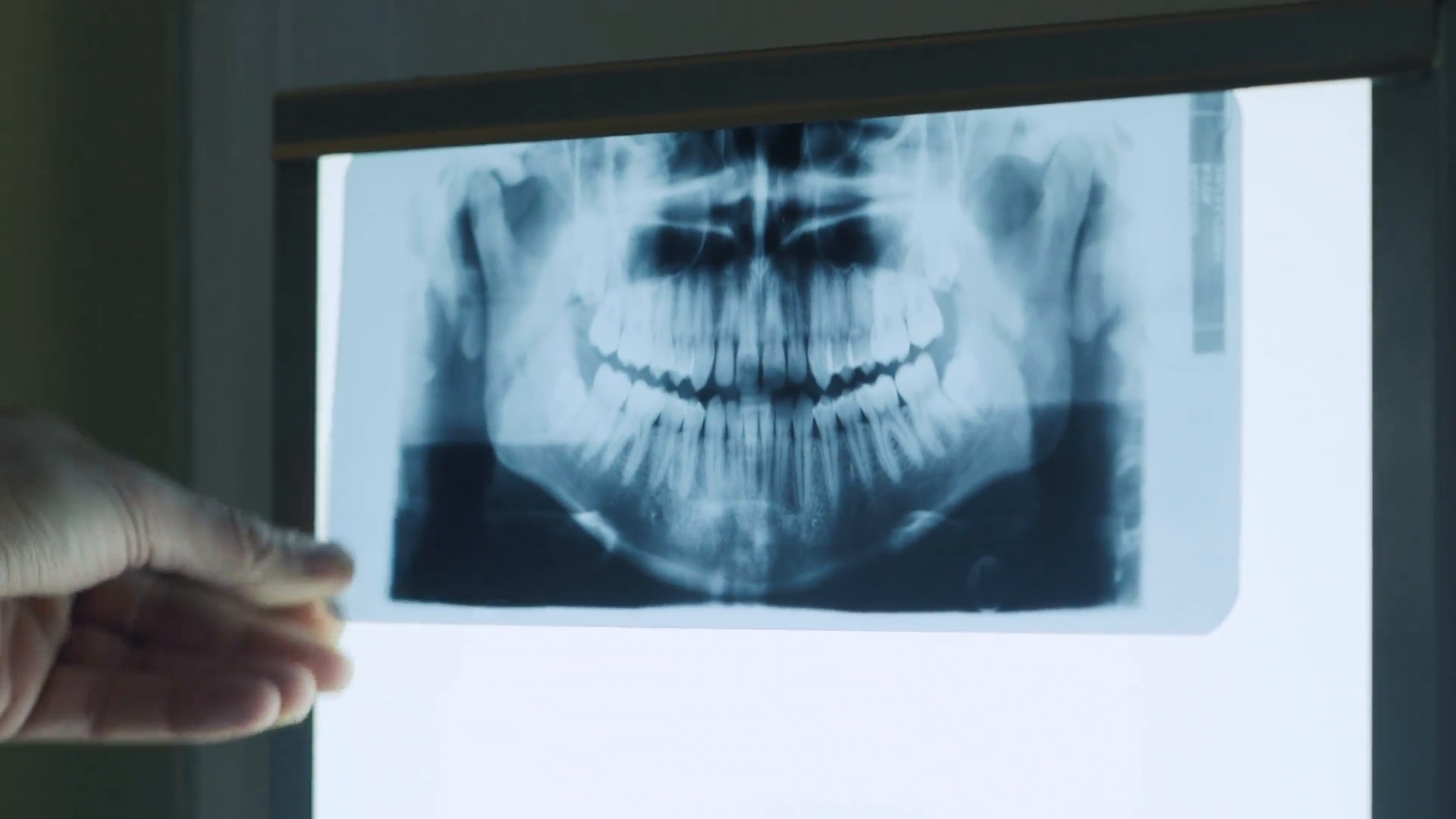 Radiography - HD Wallpaper 