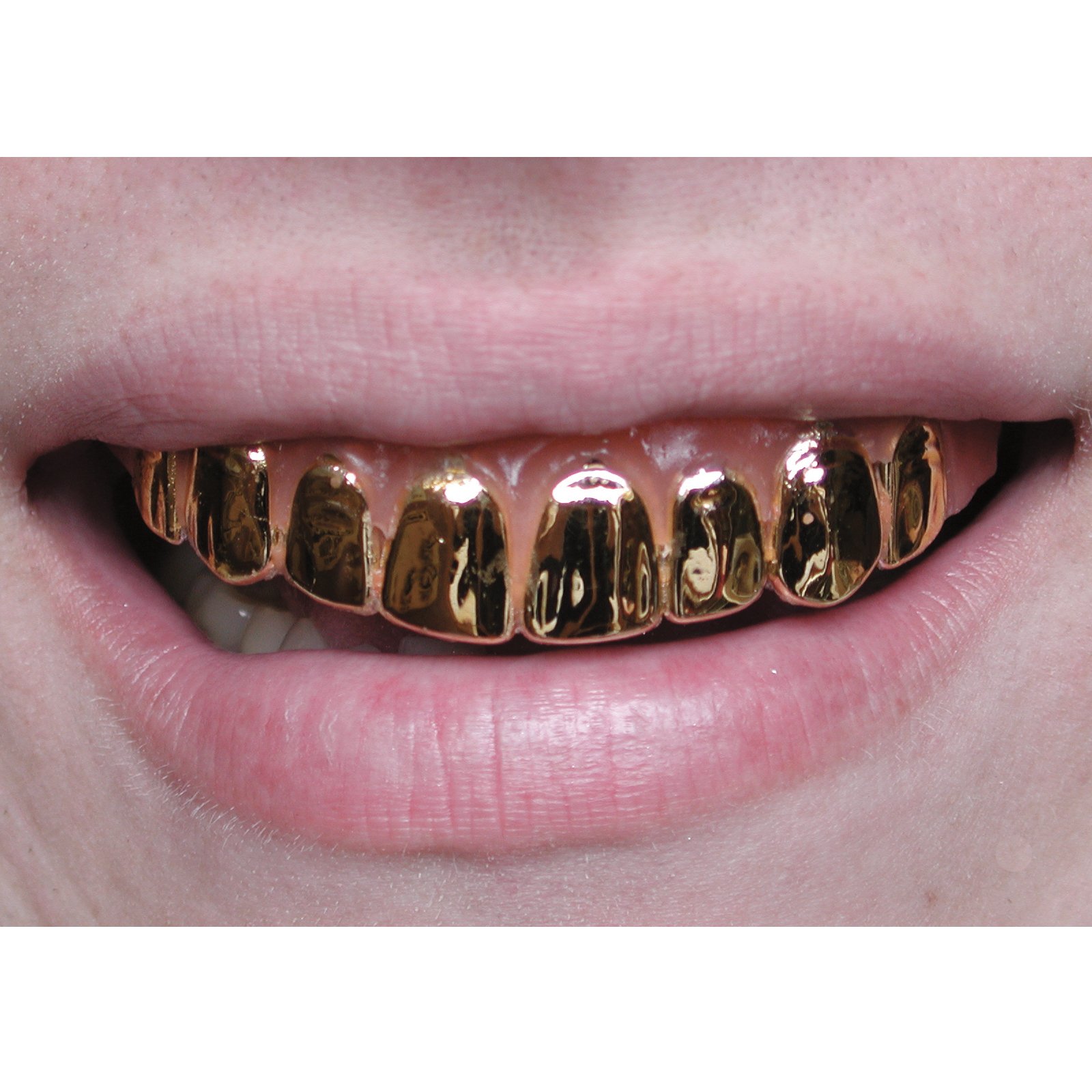 Gold Teeth Caps - Gold Teeth Dentures - HD Wallpaper 