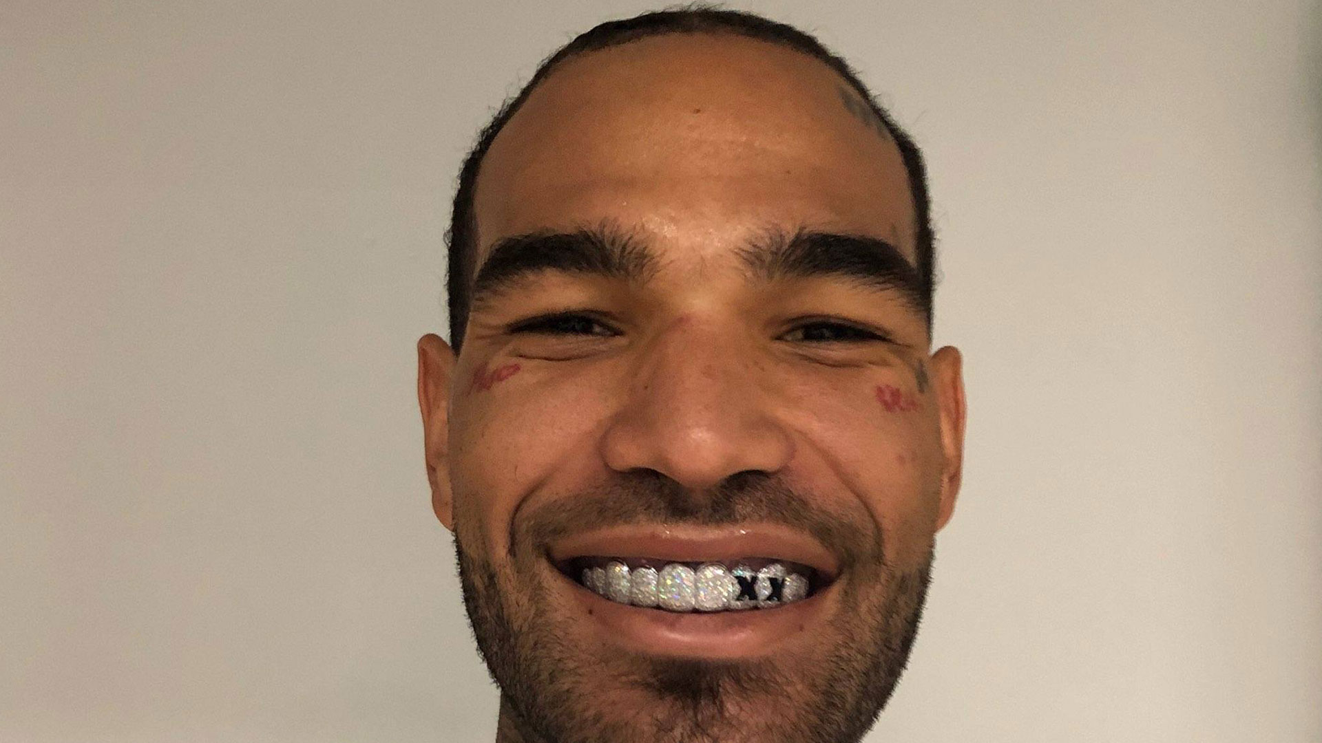 Willie Cauley Stein Teeth - HD Wallpaper 