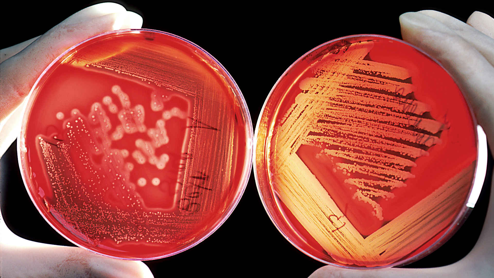 Krevní Agar - HD Wallpaper 