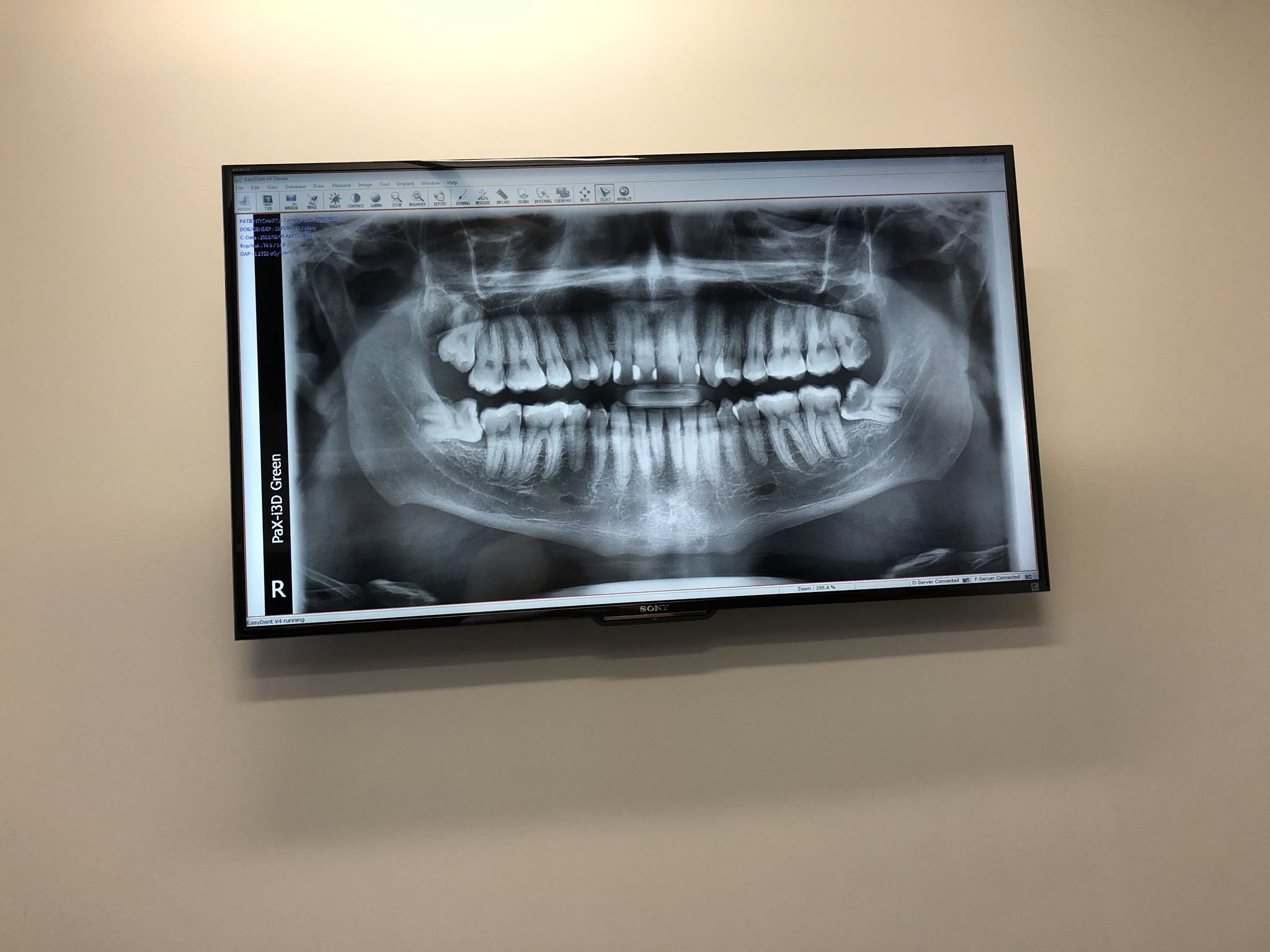 X-ray - HD Wallpaper 