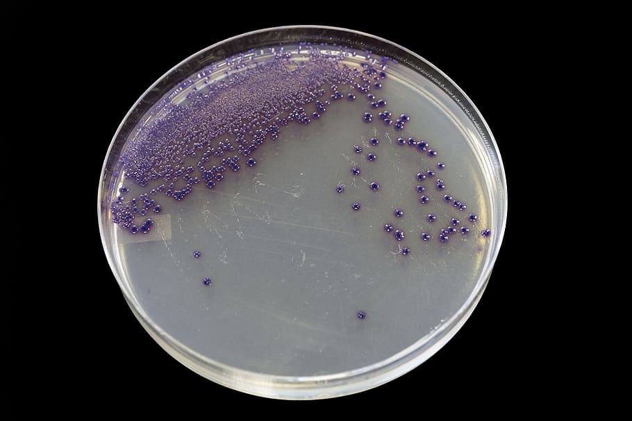 Growing E Coli In Agar - HD Wallpaper 