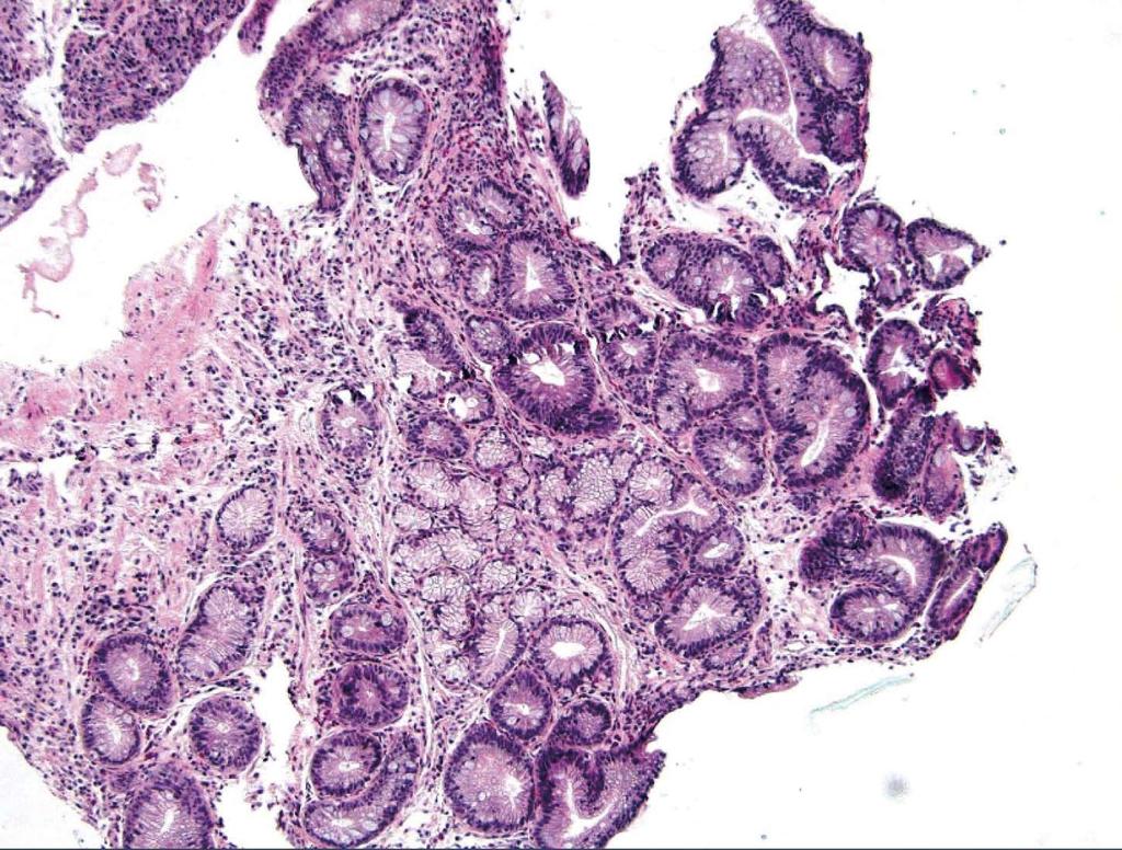 Fractal Art - HD Wallpaper 