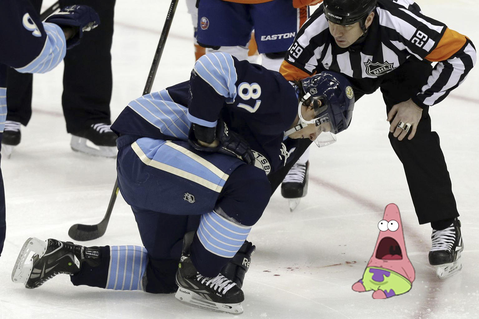 Pittsburgh Penguins College Ice Hockey Ice Hockey Ice - Sidney Crosby Broken Jaw - HD Wallpaper 