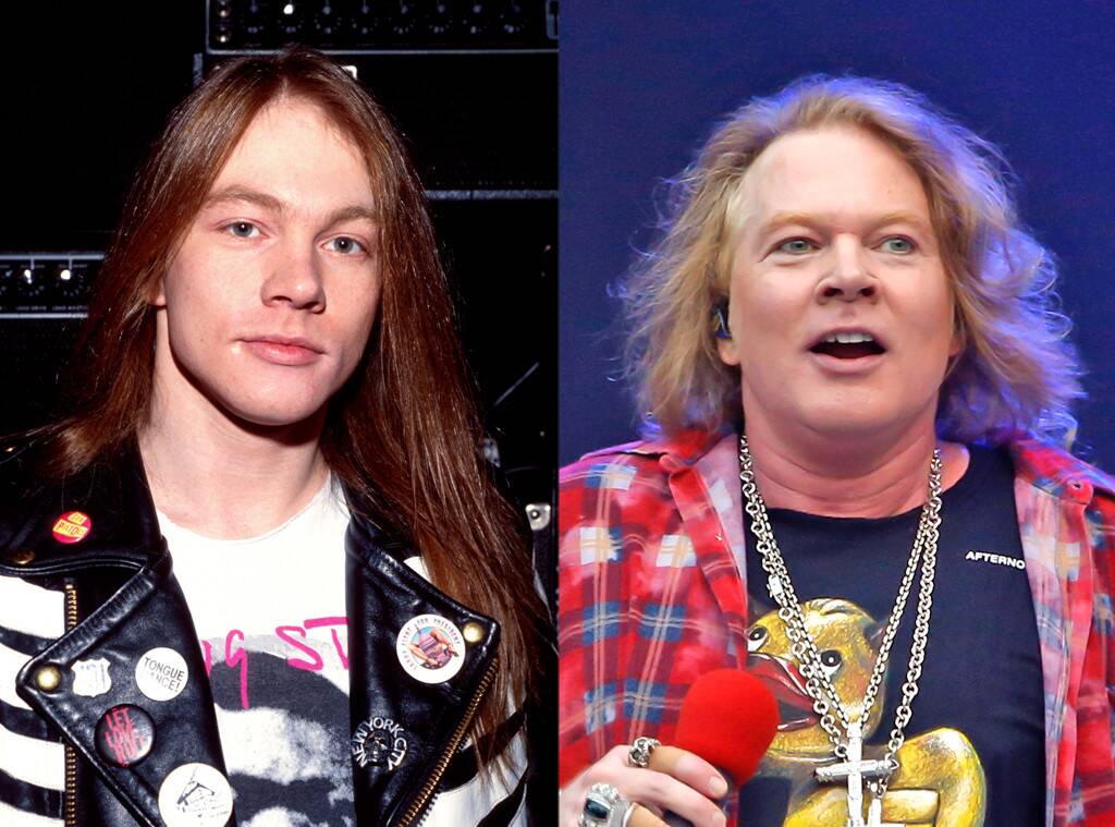 Axl Rose, Plastic Surgery, Before And After - Axl Rose Now - HD Wallpaper 