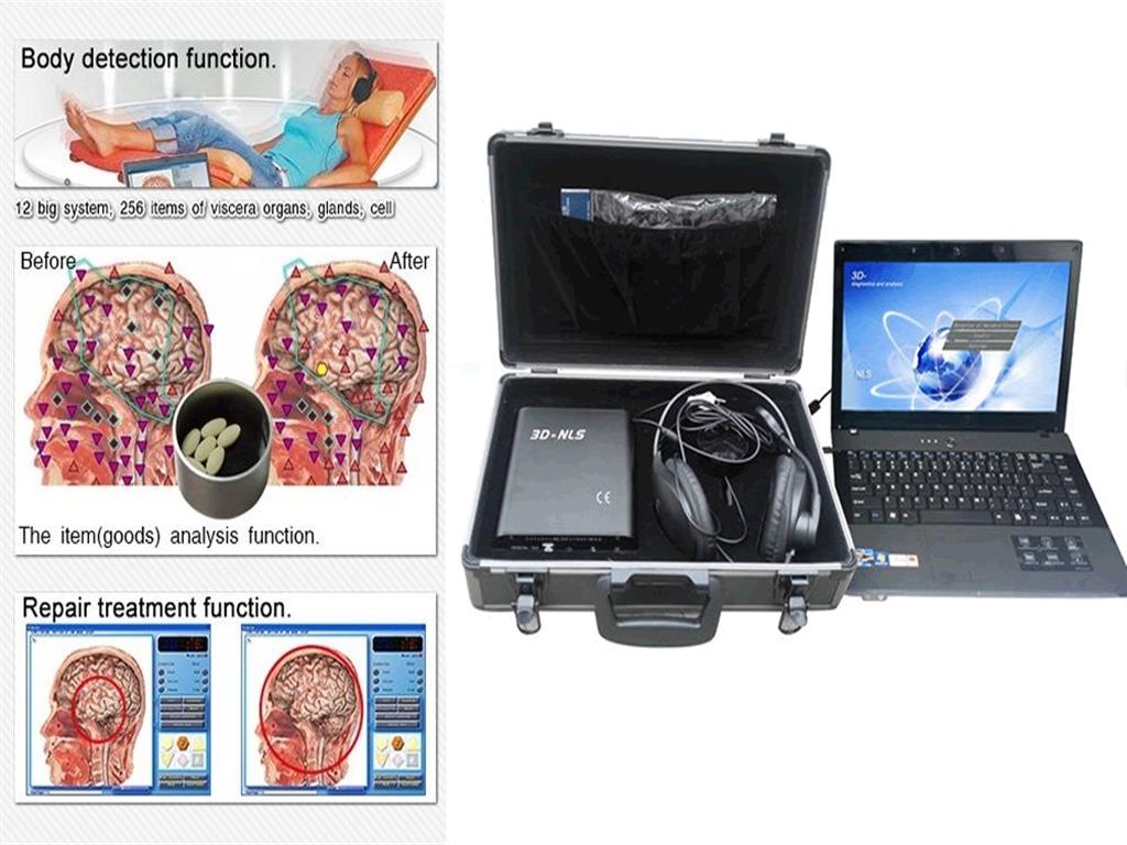 3d Nls Health Analyzer Ebay - Diacom 3d Nls - HD Wallpaper 