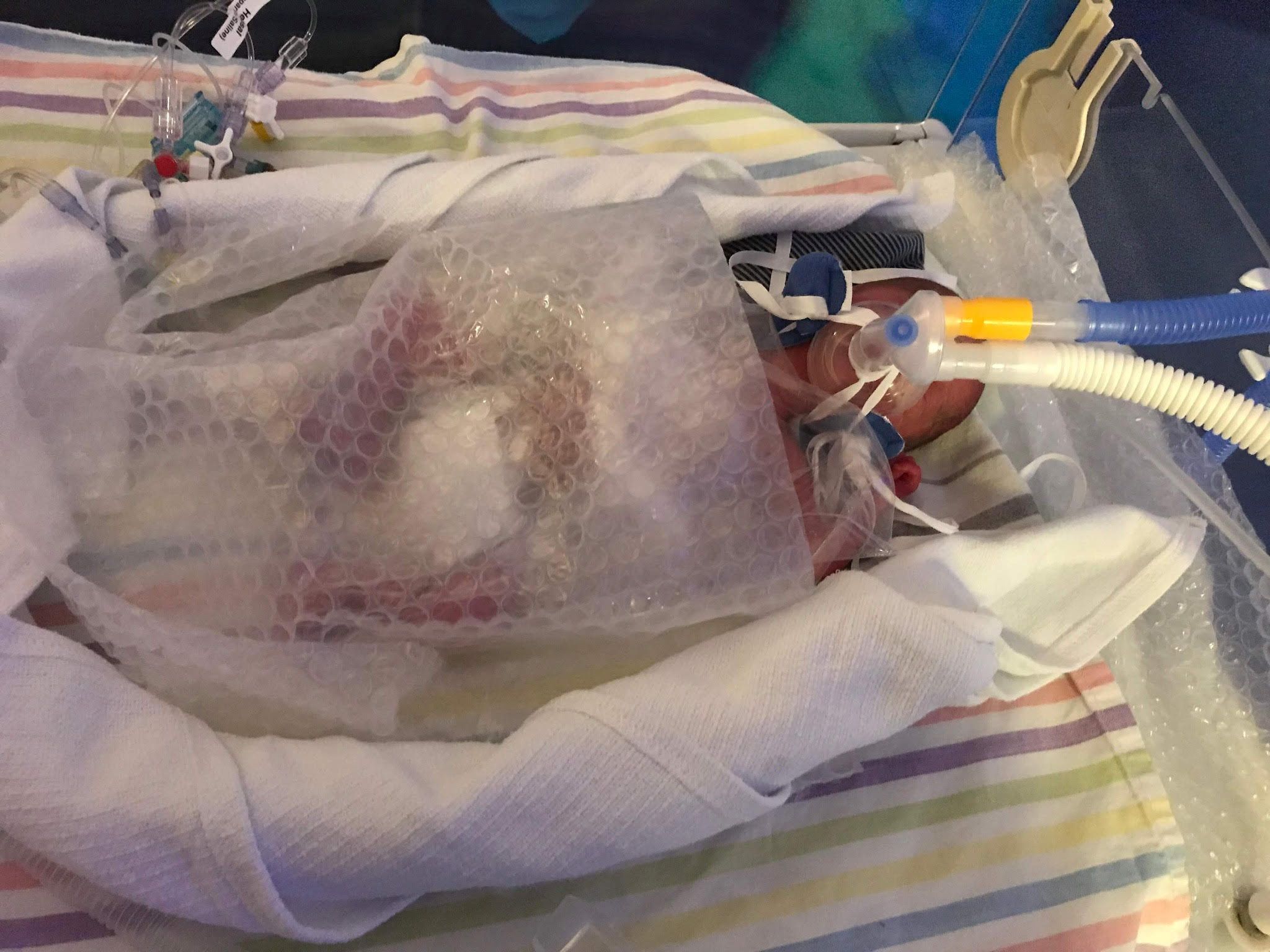 Premature Baby 2 Months Early - HD Wallpaper 