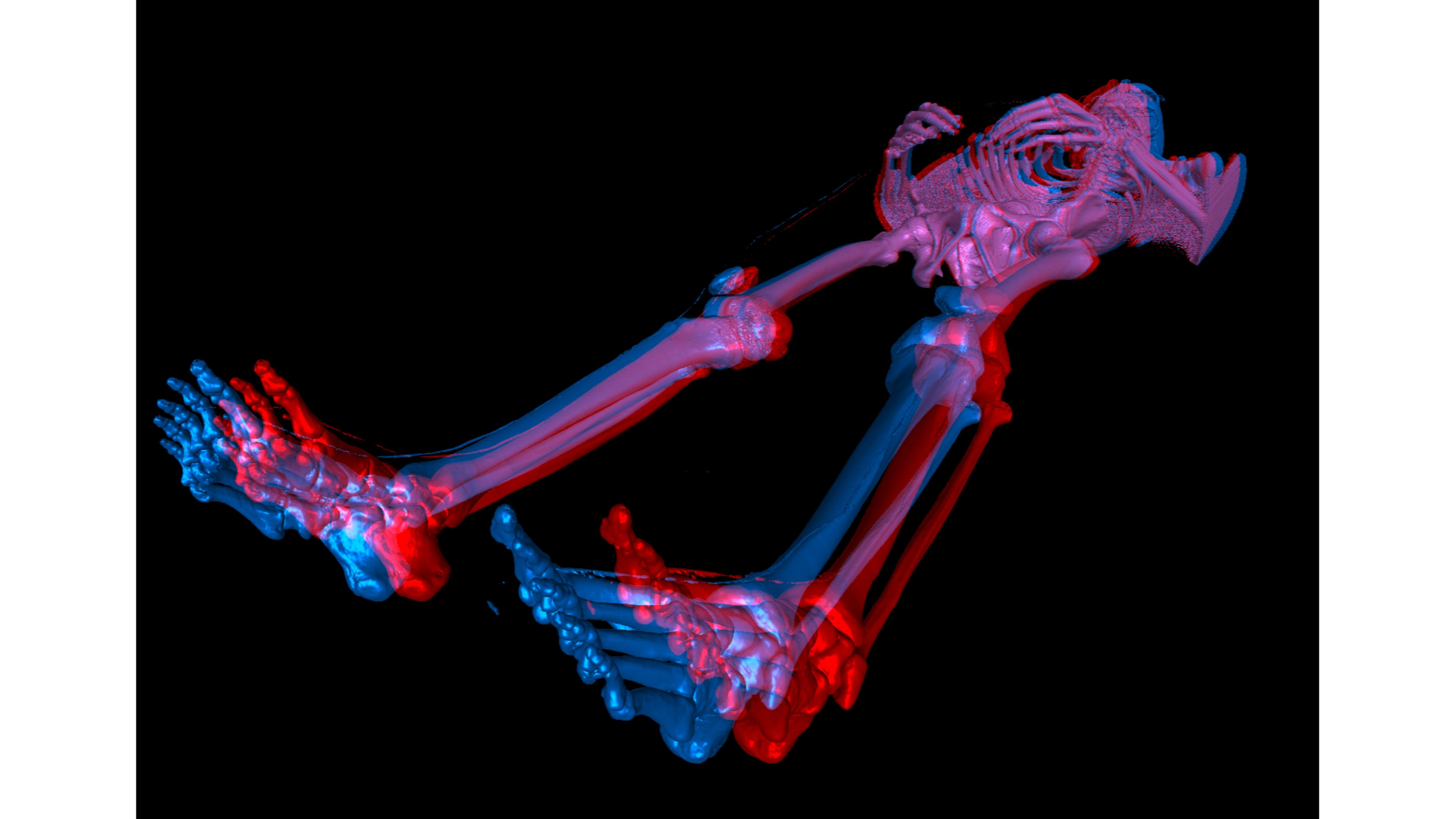 Skeleton 3d Wallpaper - Anaglyph - HD Wallpaper 