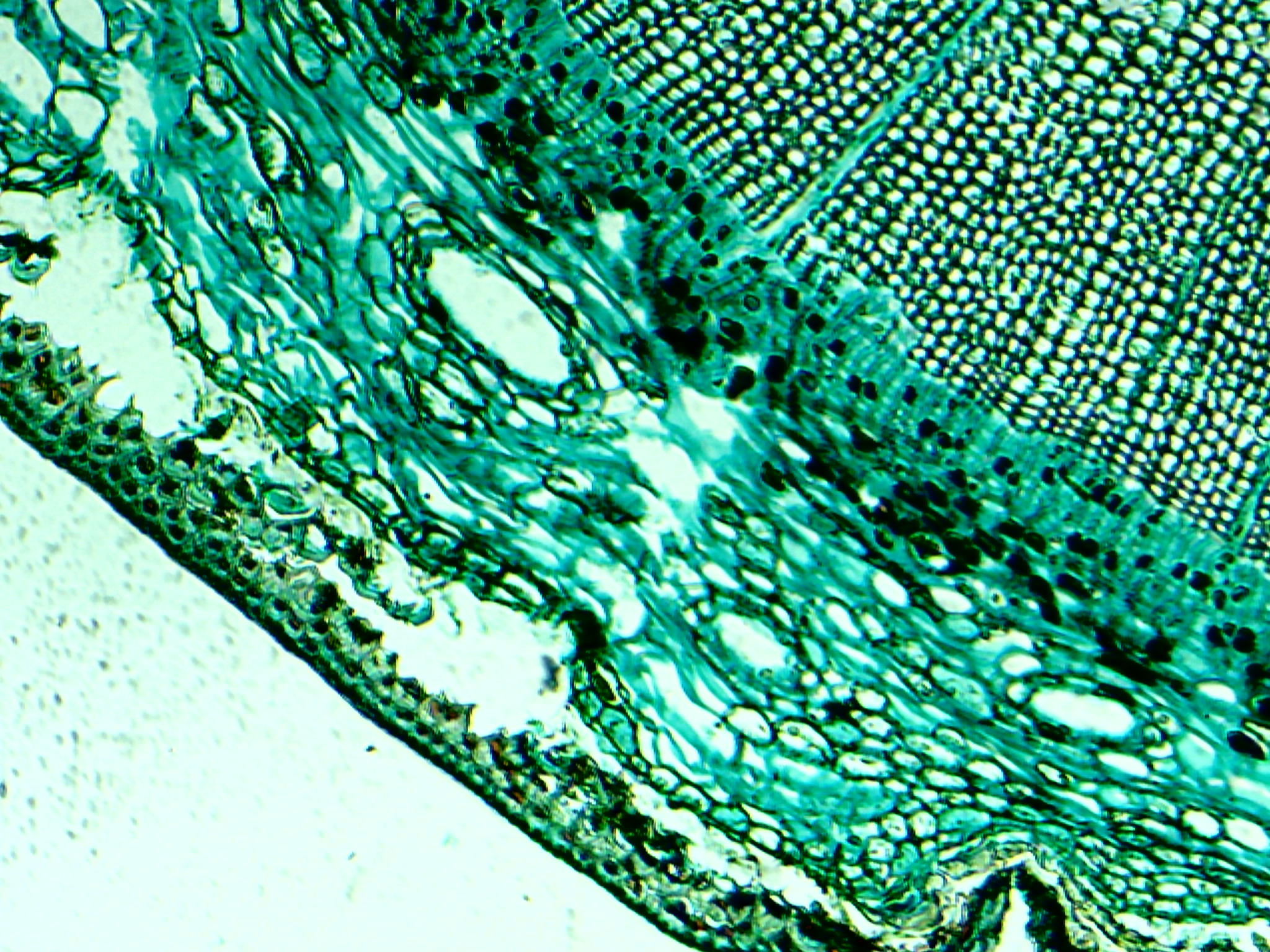 Microscope Lcd Stem Wood Dicotyledon - Cell Microscope - HD Wallpaper 