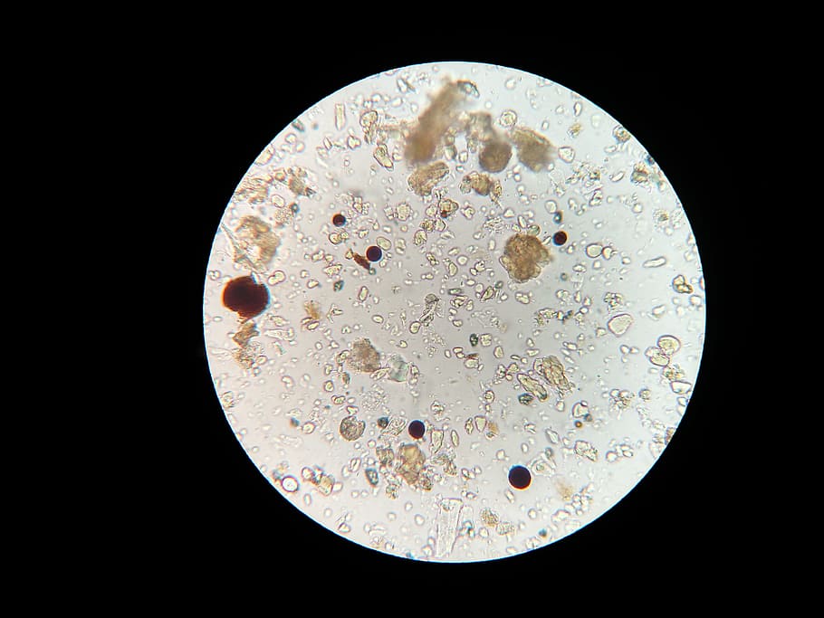 Microscopic Image, Soil Microbes, Microscope, Soil - HD Wallpaper 
