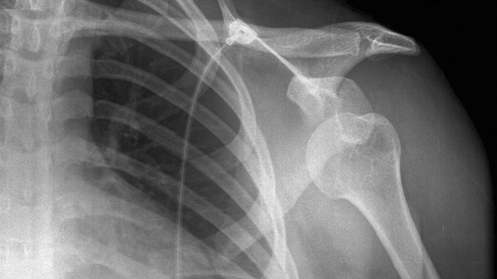 Radiography 1600x900 Wallpaper teahub.io