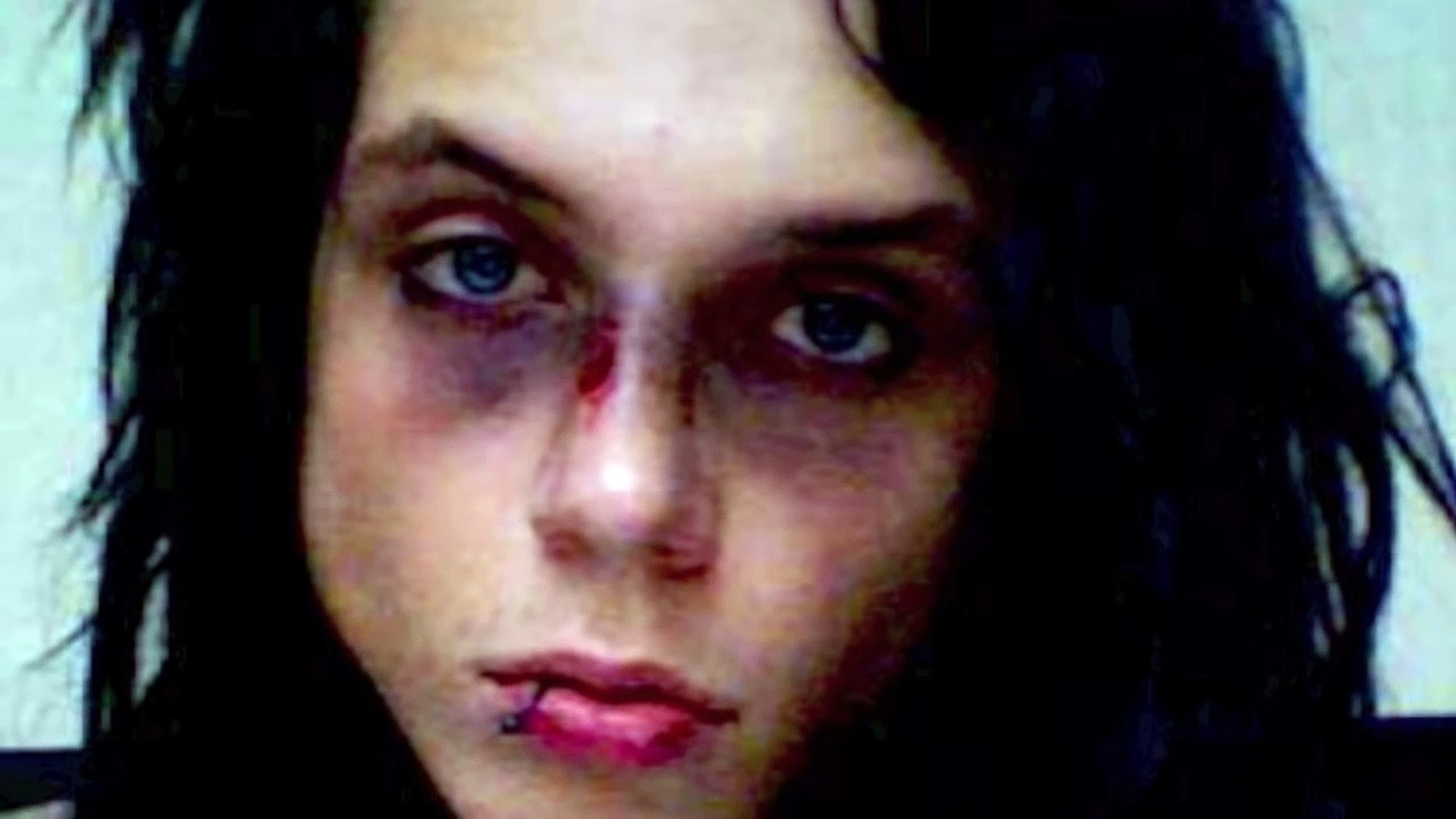 Andy Biersack Broken Nose - HD Wallpaper 