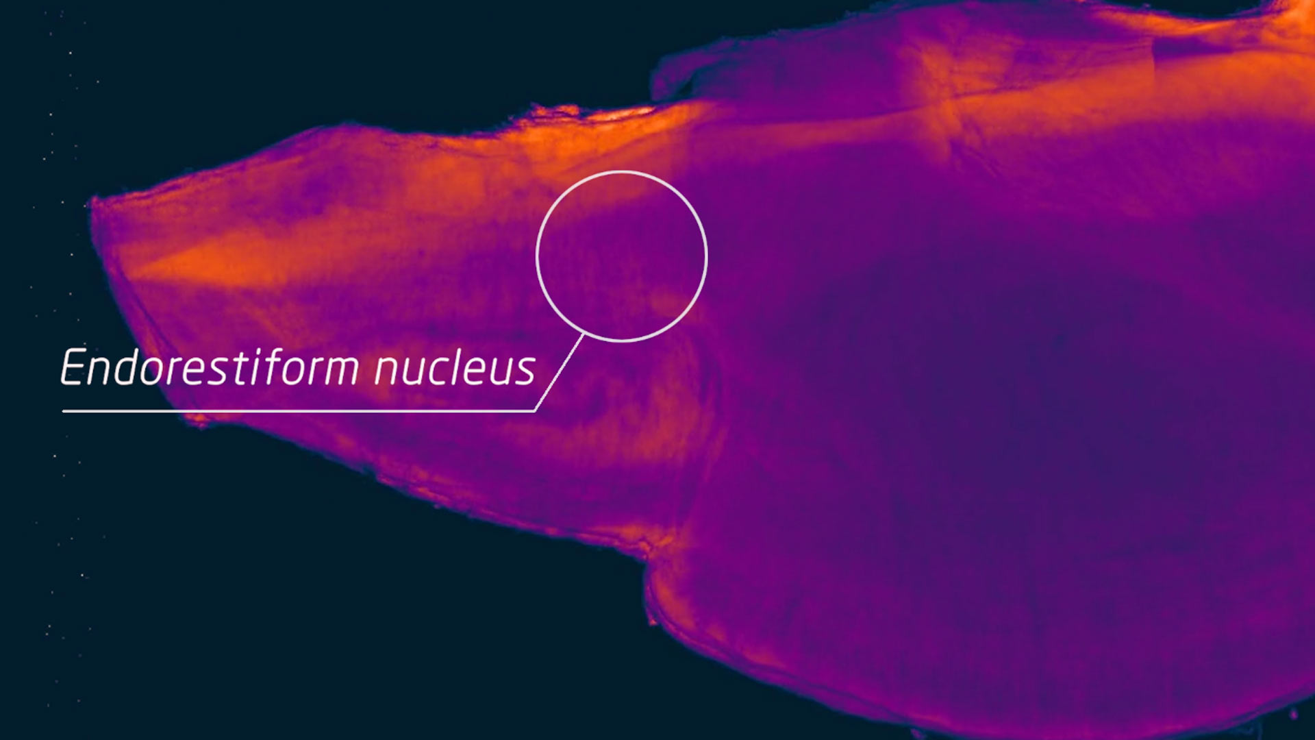 Endorestiform Nucleus - HD Wallpaper 