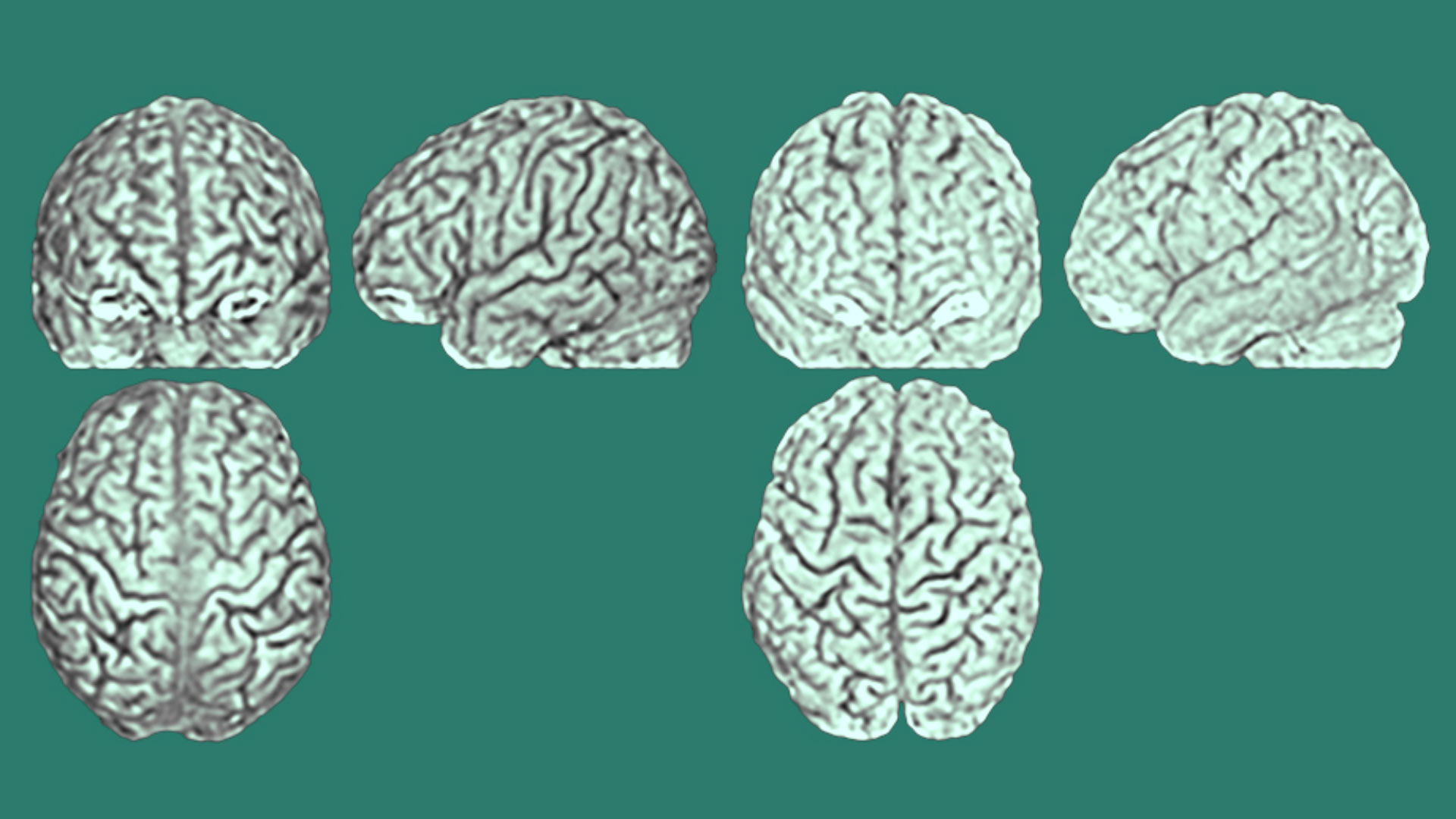 Black Person Brain Vs White Person Brain - HD Wallpaper 