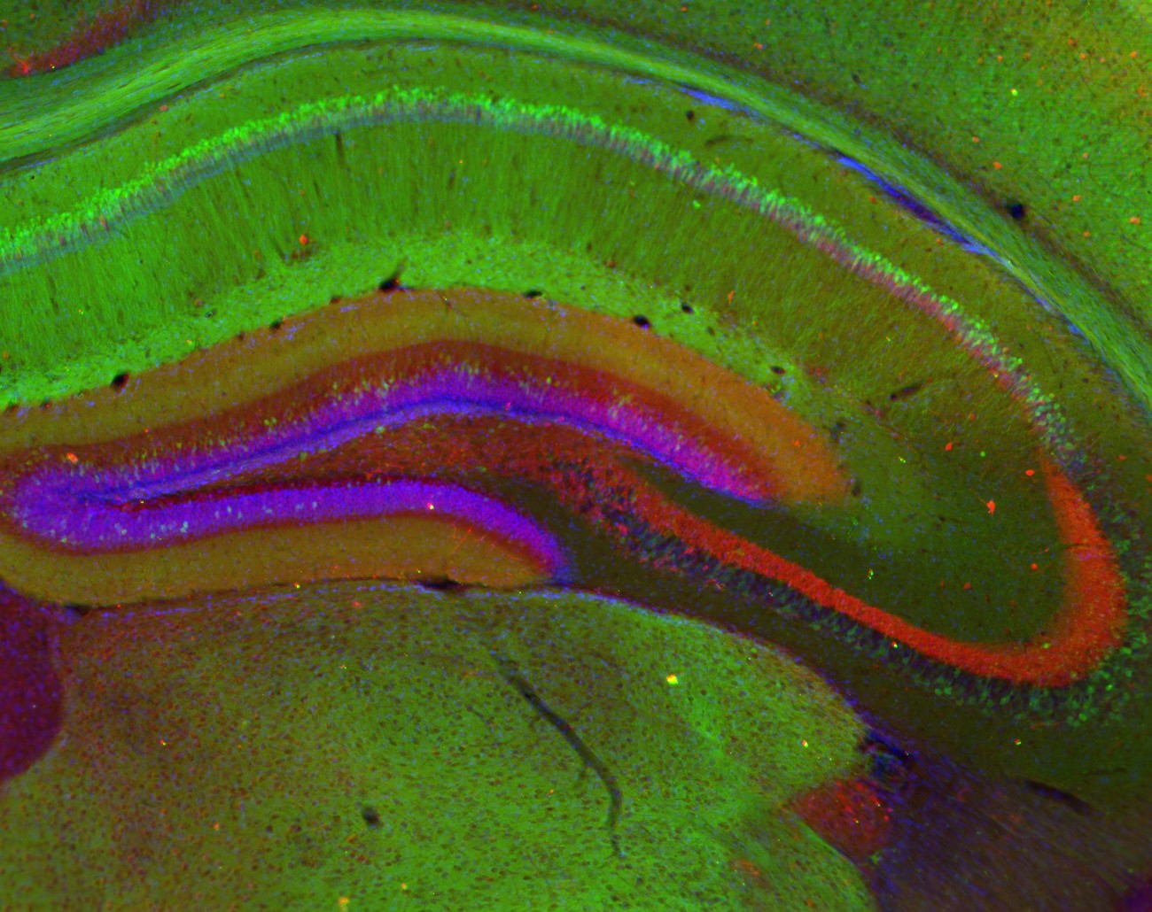 Hippocampus Gfp - HD Wallpaper 