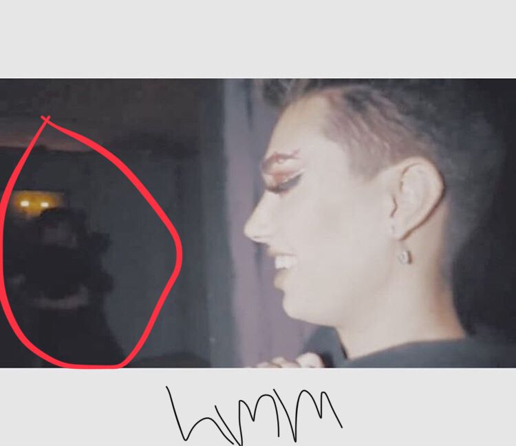 Emma Chamberlain With Hickeys - HD Wallpaper 