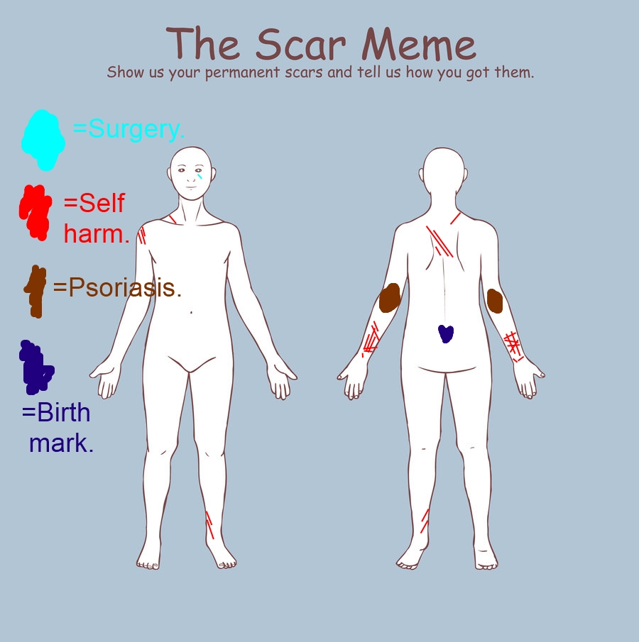 Mephy S Scar Meme - Scar Meme - HD Wallpaper 
