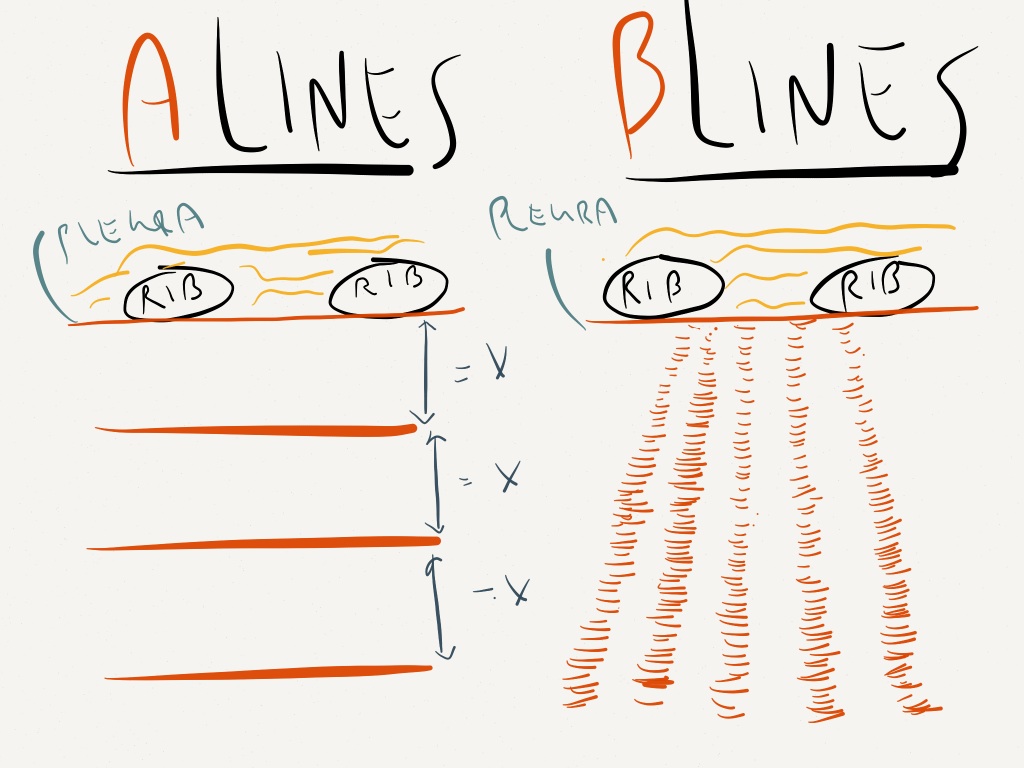 Lung Ultrasound Part 1- You Should Be Doing This Your - Lung Uss - HD Wallpaper 