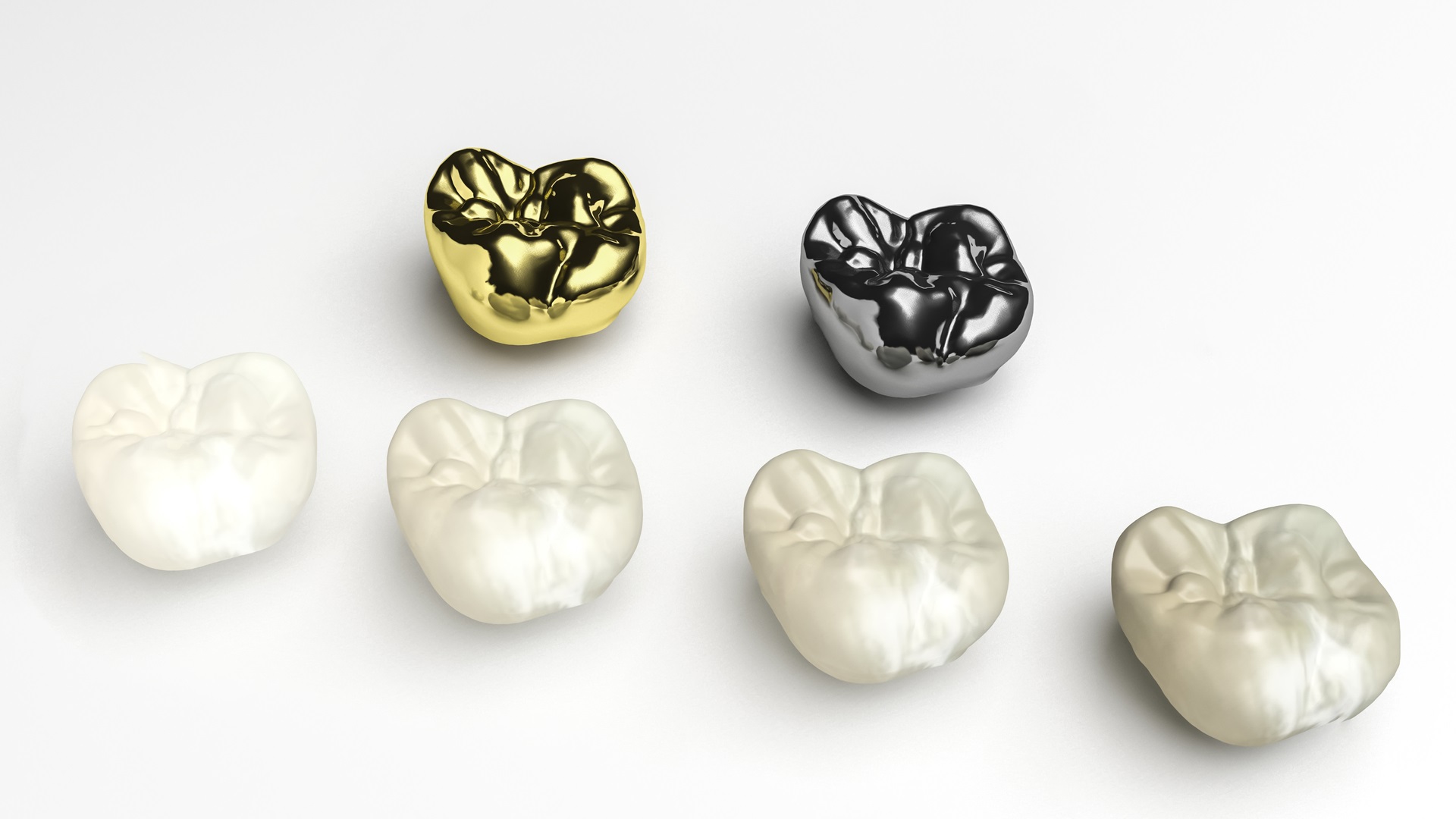 Шинирование в стоматологии. Протезы в ортопедической стоматологии. Ортопедия в стоматологии. Керамокомпозитный мостовидный протез. Съемные и несъемные протезы классификация.