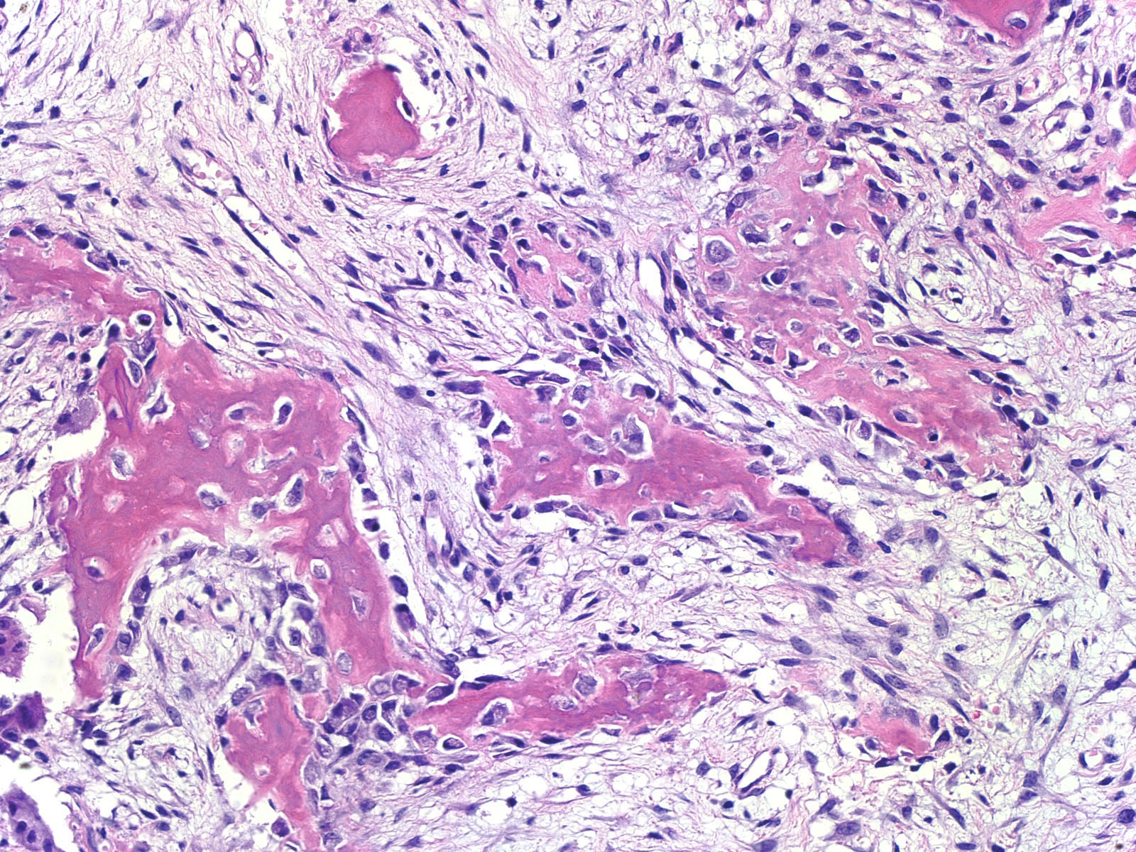 Tibia Wallpaper - HD Wallpaper 