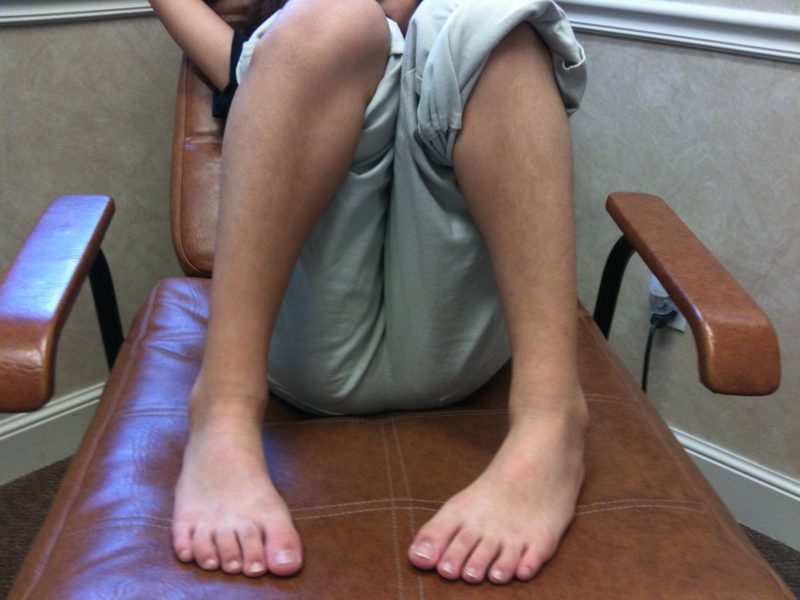 Metatarsus Adductus Adults - HD Wallpaper 