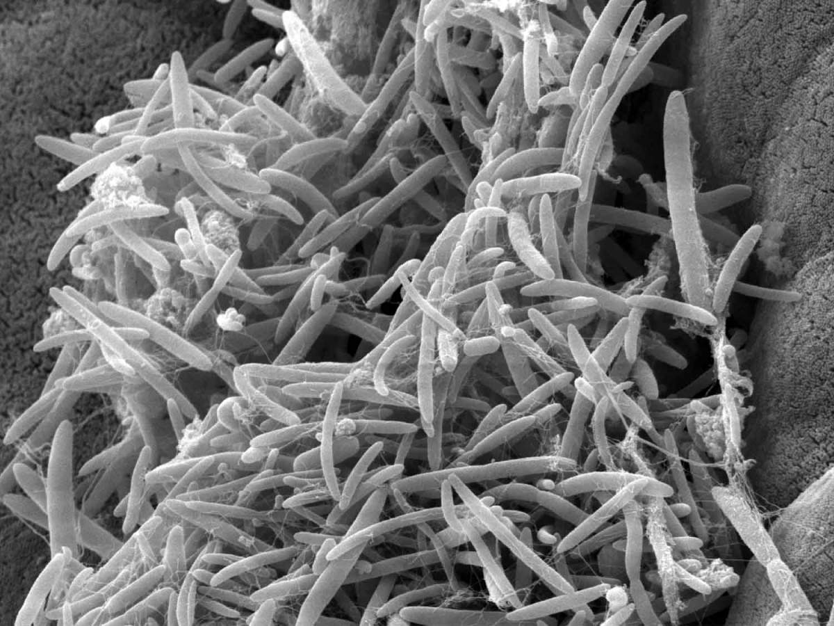 Human Gastrointestinal Microbiota - HD Wallpaper 