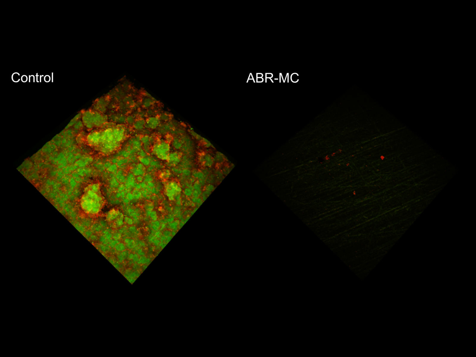 New Dental Material Resists Plaque And Kills Microbes, - Bacteria - HD Wallpaper 