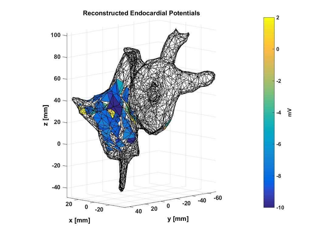 Doctors Can Use These Noninvasive Maps Of Electrochemical - Diagram - HD Wallpaper 