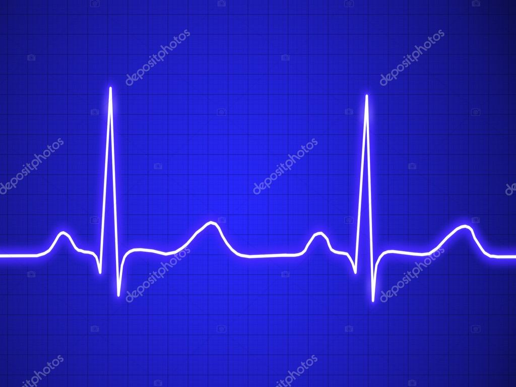 Pulso Electrocardiograma - HD Wallpaper 