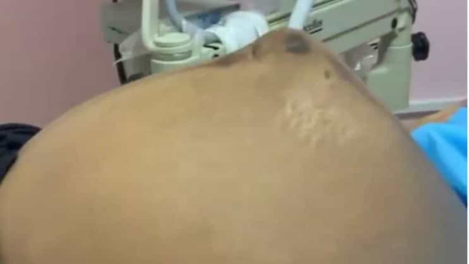 Bebé Mexe-se Surpreendentemente Na Barriga Da Mãe - Vídeo Bebê Se Mexe De Forma Surpreendente Dentro Da - HD Wallpaper 