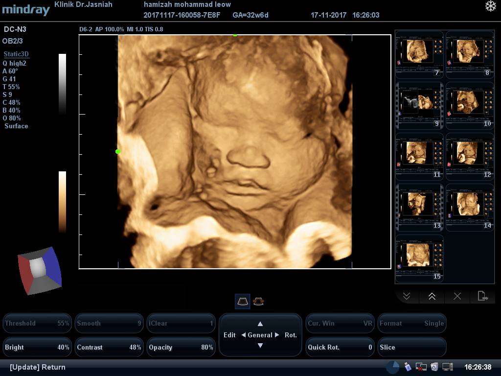 Screenshot - HD Wallpaper 